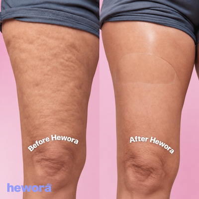 Hewora Body Lift Patches