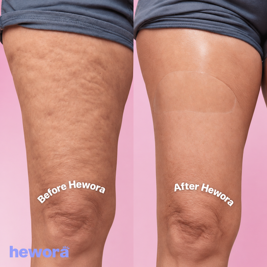 Hewora Body Lift Patches