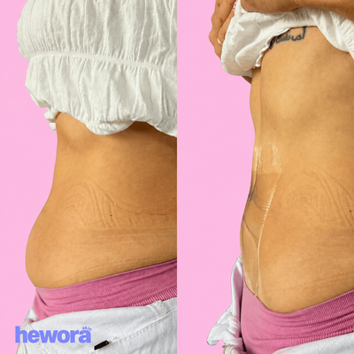 Hewora Body Lift Patches