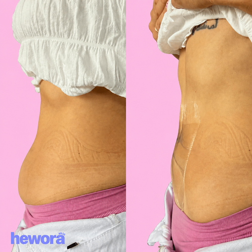 Hewora Body Lift Patches